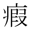 ձ